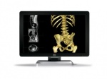 Coronis Fusion 6MP LED  MDCC-6330