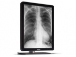 Coronis 3MP LED (MDCG-3221) 3MP premium diagnostic grayscale display system