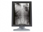 Nio 3MP (E-3620 MA) 3 MegaPixel diagnostic grayscale display system