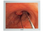 MDSC-1119 19-inch surgical color LCD display