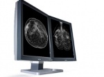 Mammo Tomosynthesis 5MP (MDMG-5221) 5 MegaPixel display system for digital breast imaging, including breast tomosynthesis