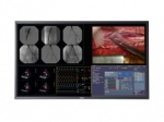 MDSC-8258 Slimline 58-inch Quad HD surgical display