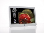 MDSC-2224 24-inch full HD surgical display