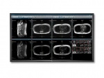 Monitor medyczny NEC MDC551C8